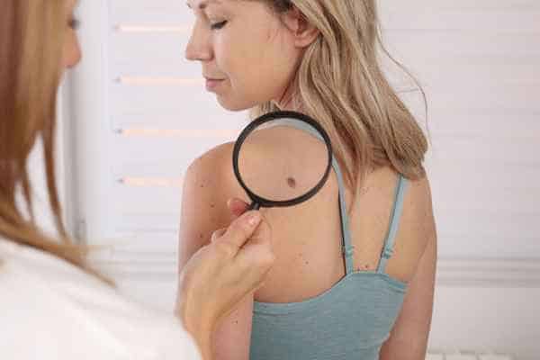 What Are Traditional Skin Lesion Removal Methods Uttoxeter?