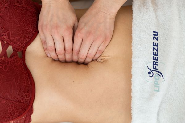 diastasis recti treatment Uttoxeter