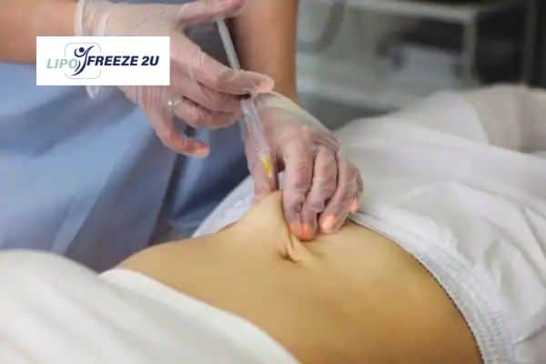 Fat Dissolving Injections Uttoxeter & Weight loss medication