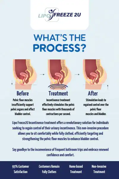 Diagram of how incontinence treatment Uttoxeter works.