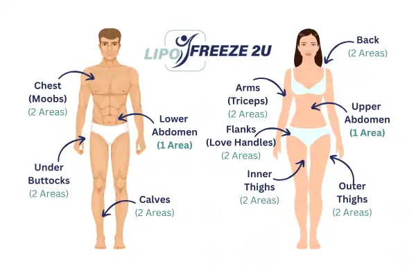 Areas you can have fat freezing treatment Uttoxeter