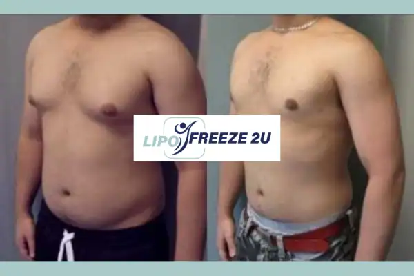 How Long Does It Take to See Results Uttoxeter?
