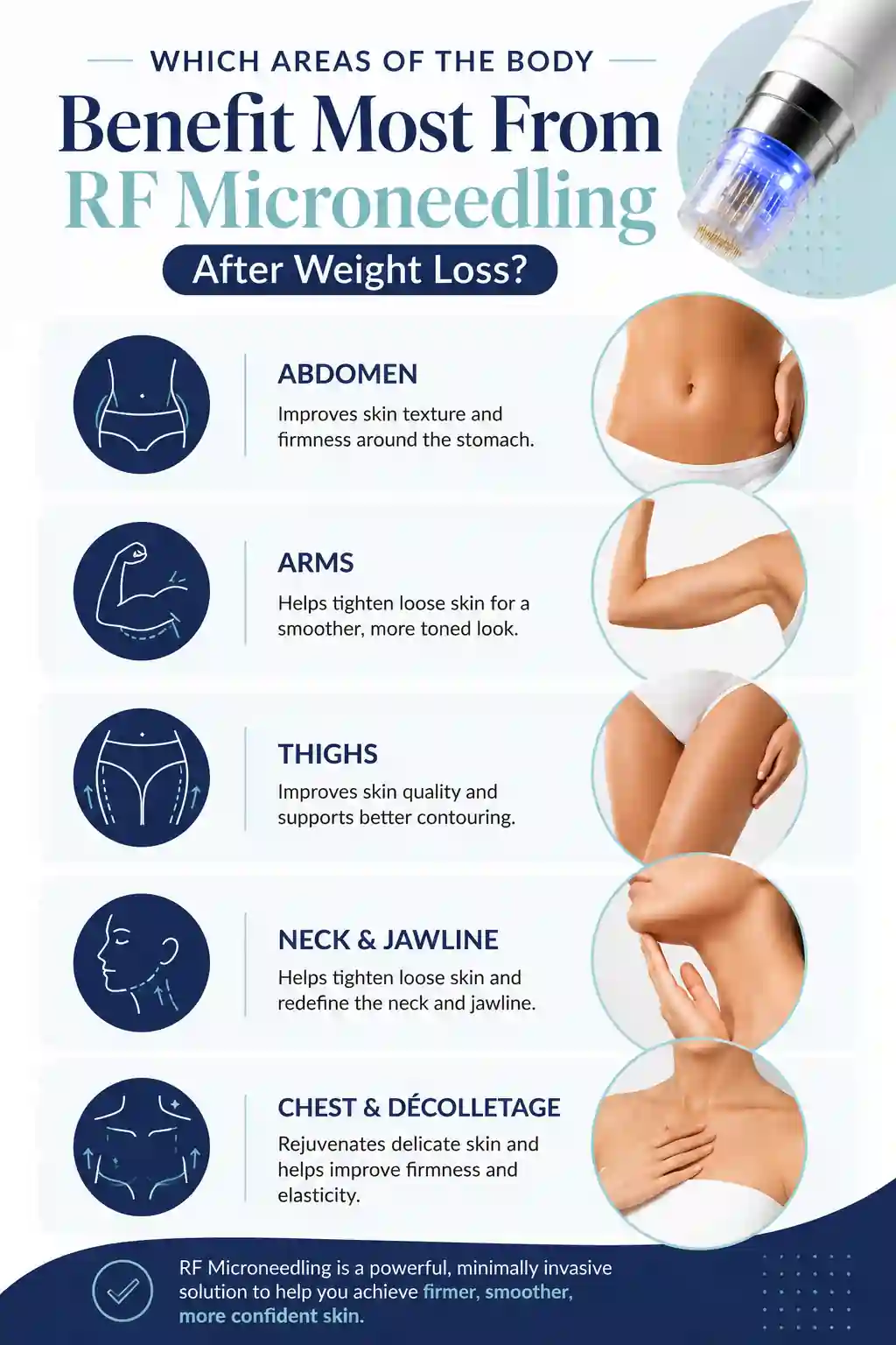 Which Areas of the Body Benefit Most From RF Microneedling After Weight Loss Uttoxeter